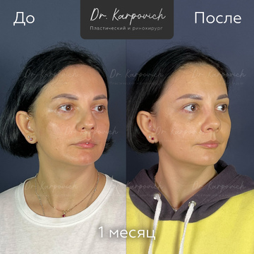 До и после. . Доктор Сергей Карпович