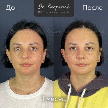 До и после. . Доктор Сергей Карпович