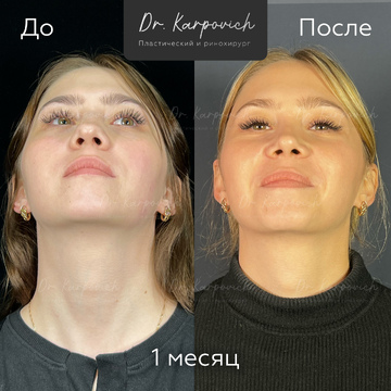 До и после. . Доктор Сергей Карпович