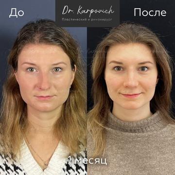 До и после. . Доктор Сергей Карпович
