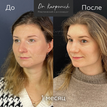 До и после. . Доктор Сергей Карпович