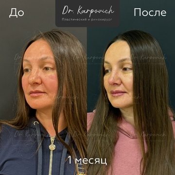 До и после. . Доктор Сергей Карпович