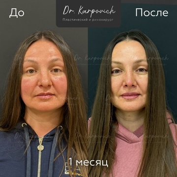 До и после. . Доктор Сергей Карпович