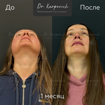 До и после. . Доктор Сергей Карпович
