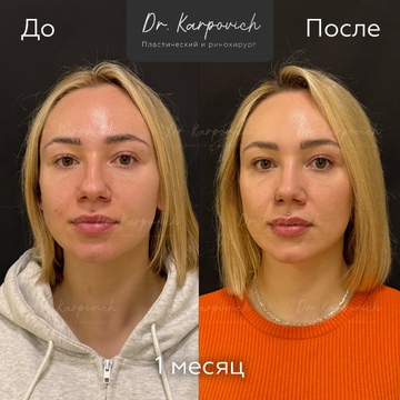 До и после. . Доктор Сергей Карпович