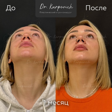 До и после. . Доктор Сергей Карпович