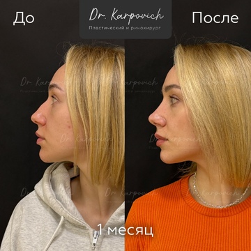 До и после. . Доктор Сергей Карпович